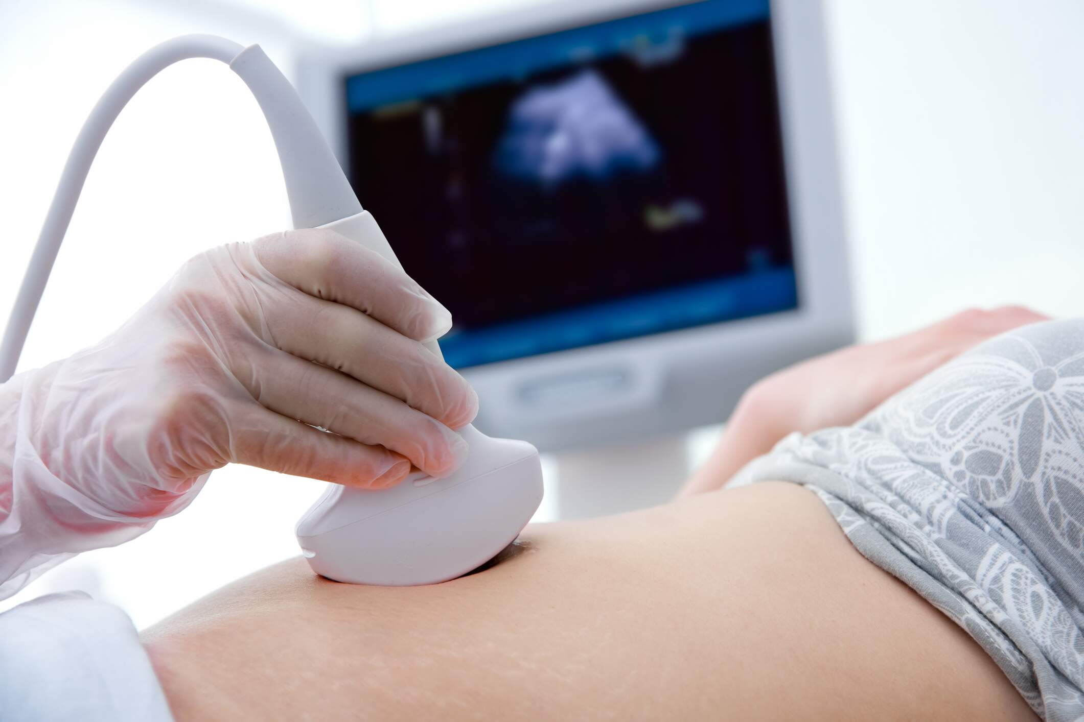 A importância da Ultrassonografia